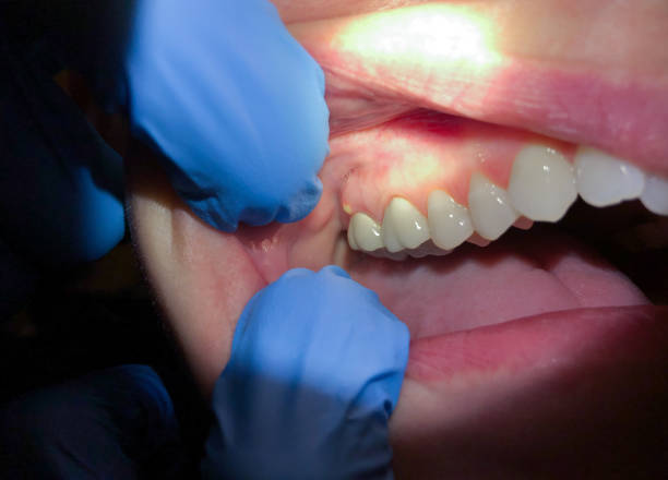 Best Walk-In Emergency Dental Services in South Fulton, GA