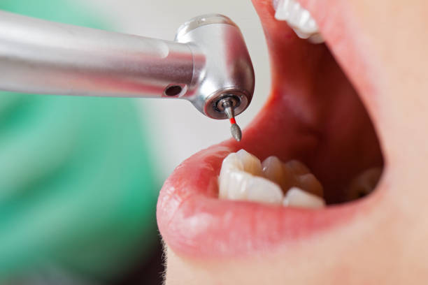 Best Weekend Emergency Dental Services in South Fulton, GA